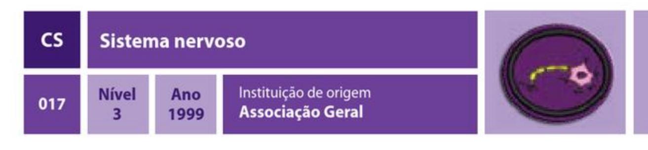 Sistema nervoso